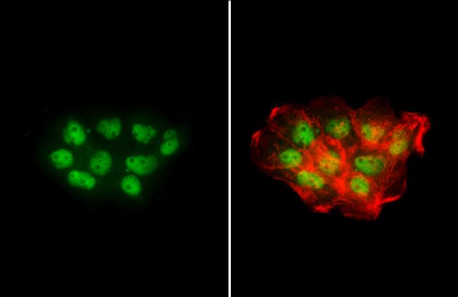 NBS1 Antibody in Immunocytochemistry (ICC/IF)