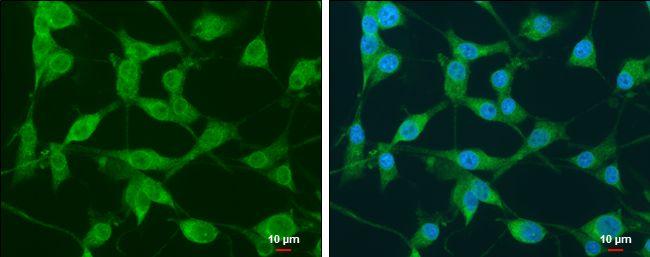 NEK1 Antibody in Immunocytochemistry (ICC/IF)