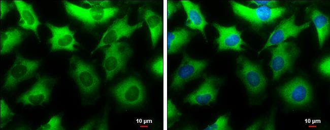 NMT1 Antibody in Immunocytochemistry (ICC/IF)