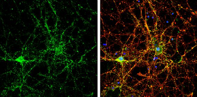 NSF Antibody in Immunocytochemistry (ICC/IF)