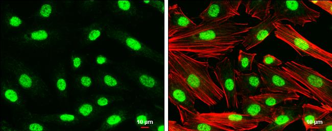 Nurr1 Antibody in Immunocytochemistry (ICC/IF)