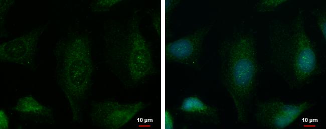 PHKA1 Antibody in Immunocytochemistry (ICC/IF)