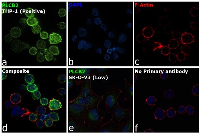 PLCB2 Antibody in Immunocytochemistry (ICC/IF)