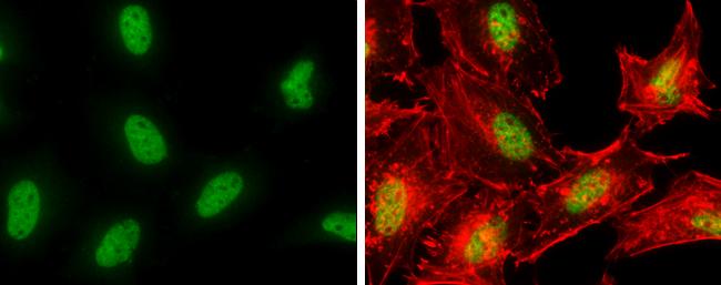 POLE Antibody in Immunocytochemistry (ICC/IF)