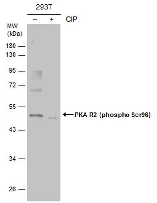 Phospho-PRKAR2A (Ser96) Antibody in Western Blot (WB)