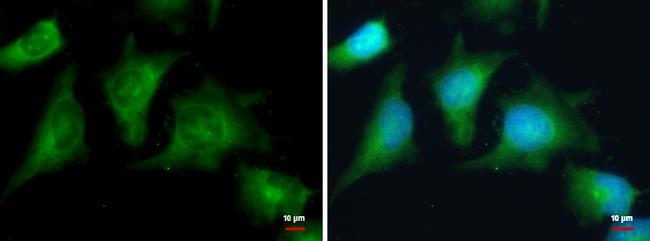 PRKAR2A Antibody in Immunocytochemistry (ICC/IF)