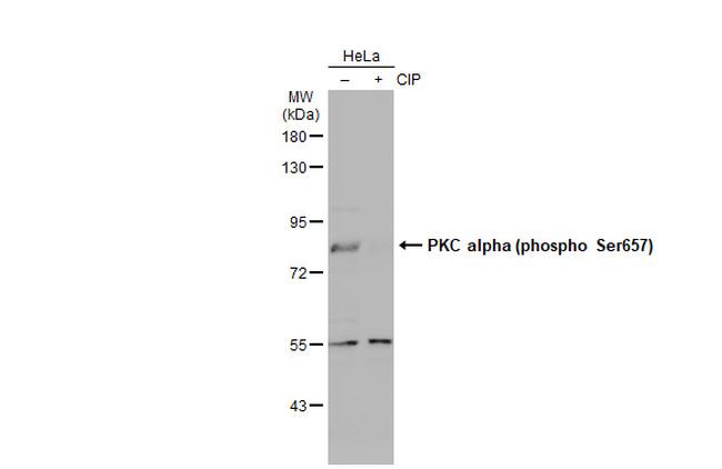 Phospho-PKC alpha (Ser657) Antibody in Western Blot (WB)