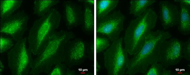 PKC mu Antibody in Immunocytochemistry (ICC/IF)