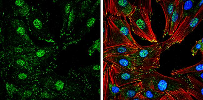 Phospho-FAK (Tyr407) Antibody in Immunocytochemistry (ICC/IF)