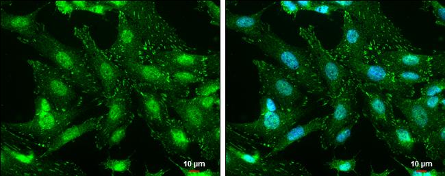 Phospho-FAK (Tyr576) Antibody in Immunocytochemistry (ICC/IF)