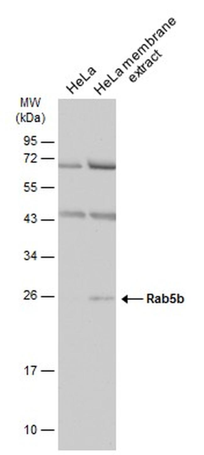 RAB5B Antibody in Western Blot (WB)