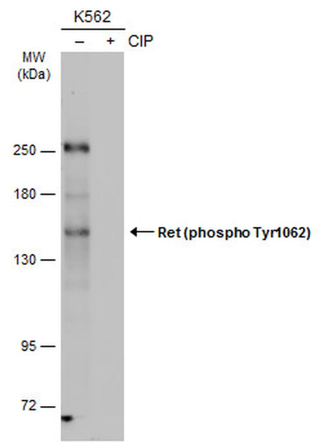 Phospho-RET (Tyr1062) Antibody in Western Blot (WB)