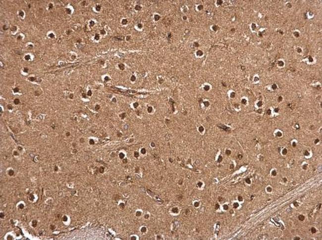 RSK2 Antibody in Immunohistochemistry (Paraffin) (IHC (P))