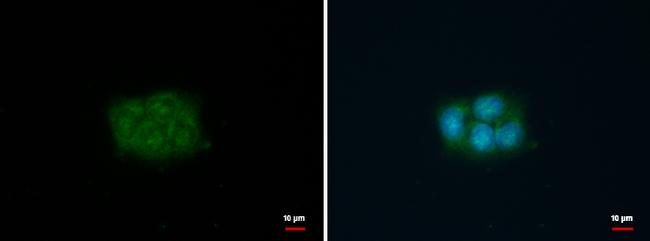 Fascin Antibody in Immunocytochemistry (ICC/IF)