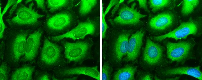 SOS1 Antibody in Immunocytochemistry (ICC/IF)