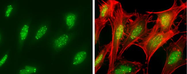 SP100 Antibody in Immunocytochemistry (ICC/IF)