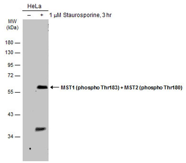 Phospho-MST1/MST2 (Thr183, Thr180) Antibody in Western Blot (WB)