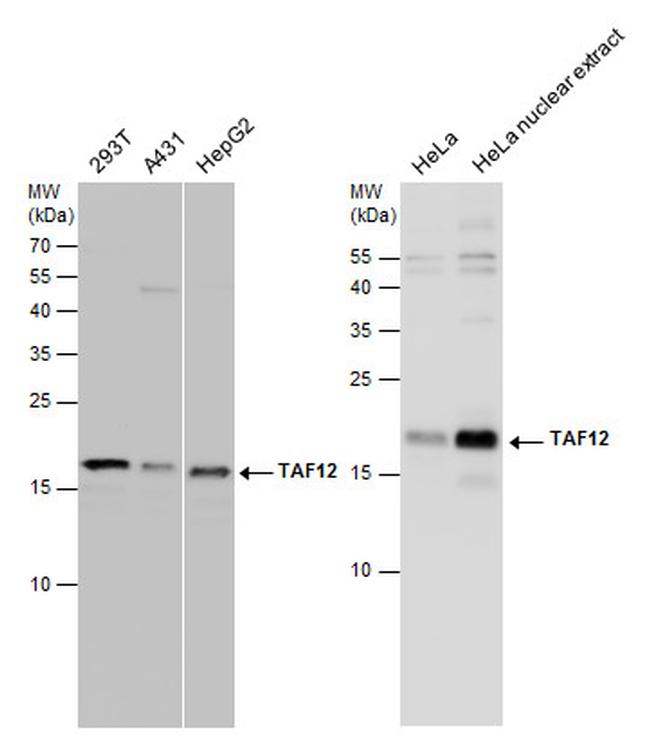 TAF12 Antibody in Western Blot (WB)