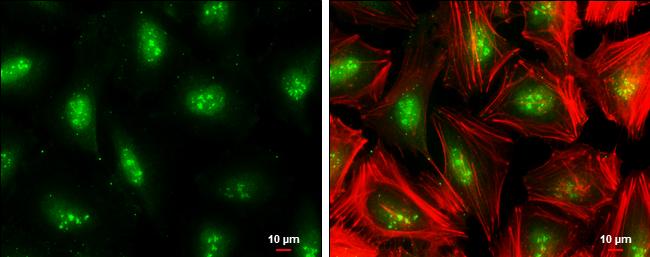 TCF7L2 Antibody in Immunocytochemistry (ICC/IF)