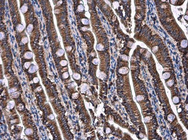 UQCRB Antibody in Immunohistochemistry (Paraffin) (IHC (P))