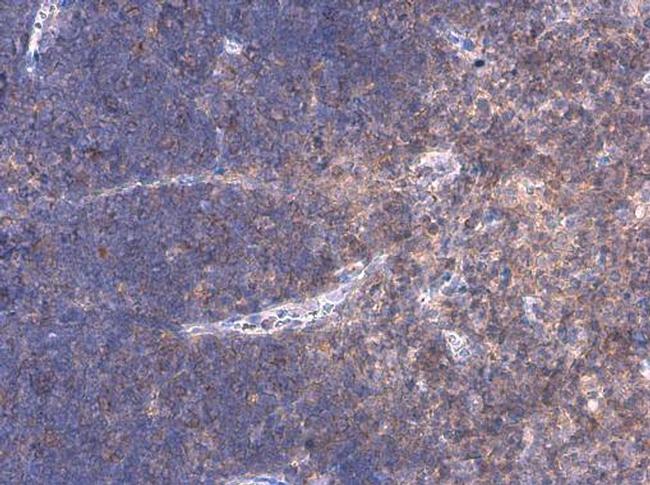 WASP Antibody in Immunohistochemistry (Paraffin) (IHC (P))