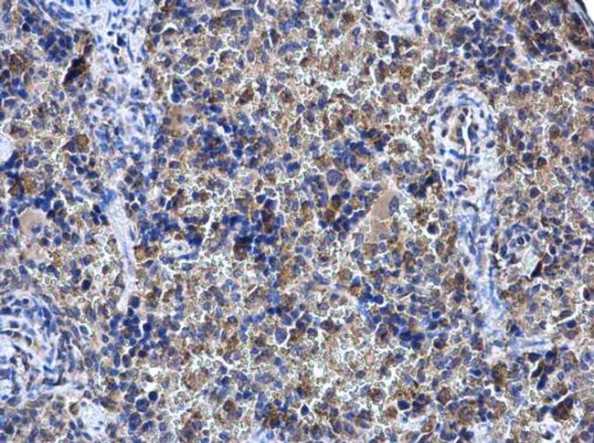 SHOC2 Antibody in Immunohistochemistry (Paraffin) (IHC (P))