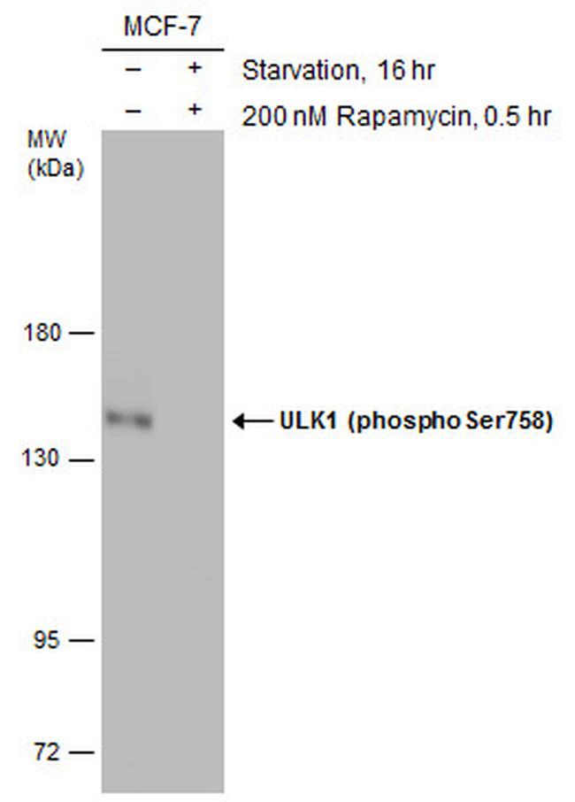 Phospho-ULK1 (Ser758) Antibody in Western Blot (WB)