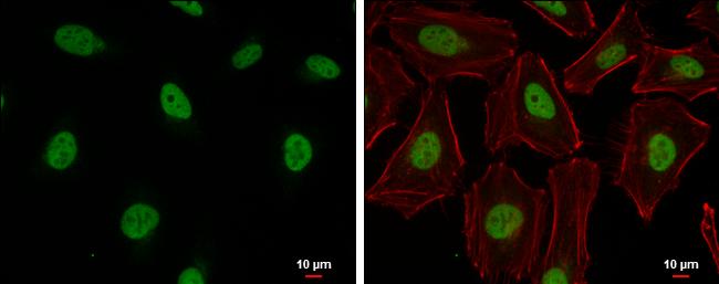 Cullin 4B Antibody in Immunocytochemistry (ICC/IF)