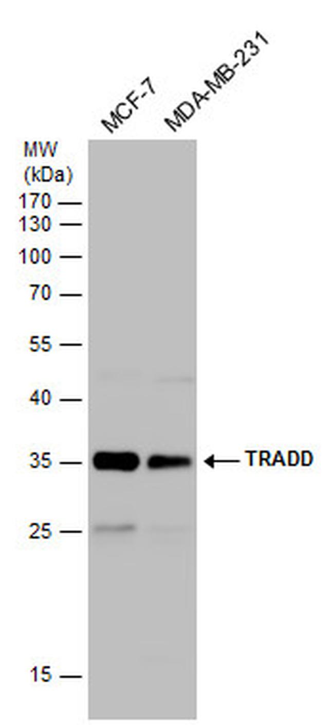 TRADD Antibody in Western Blot (WB)