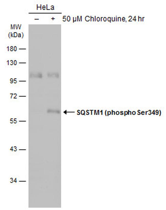 Phospho-SQSTM1 (Ser349) Antibody in Western Blot (WB)