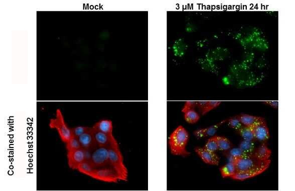 Phospho-SQSTM1 (Ser403) Antibody in Immunocytochemistry (ICC/IF)