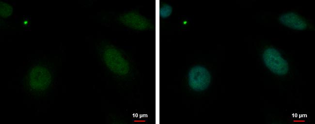 MBD4 Antibody in Immunocytochemistry (ICC/IF)