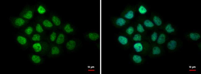 MTA1 Antibody in Immunocytochemistry (ICC/IF)