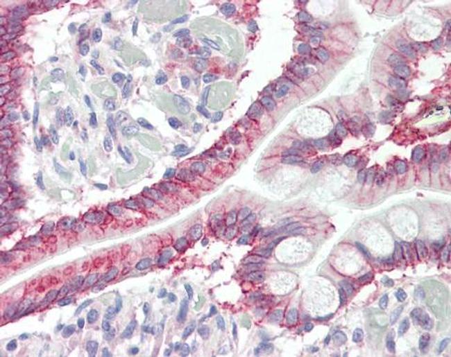 GPR52 Antibody in Immunohistochemistry (Paraffin) (IHC (P))