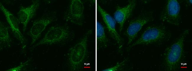 CER1 Antibody in Immunocytochemistry (ICC/IF)