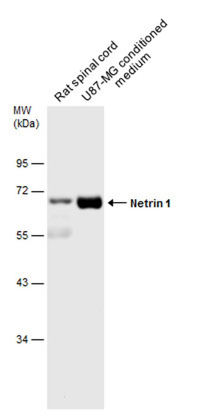 NTN1 Antibody in Western Blot (WB)