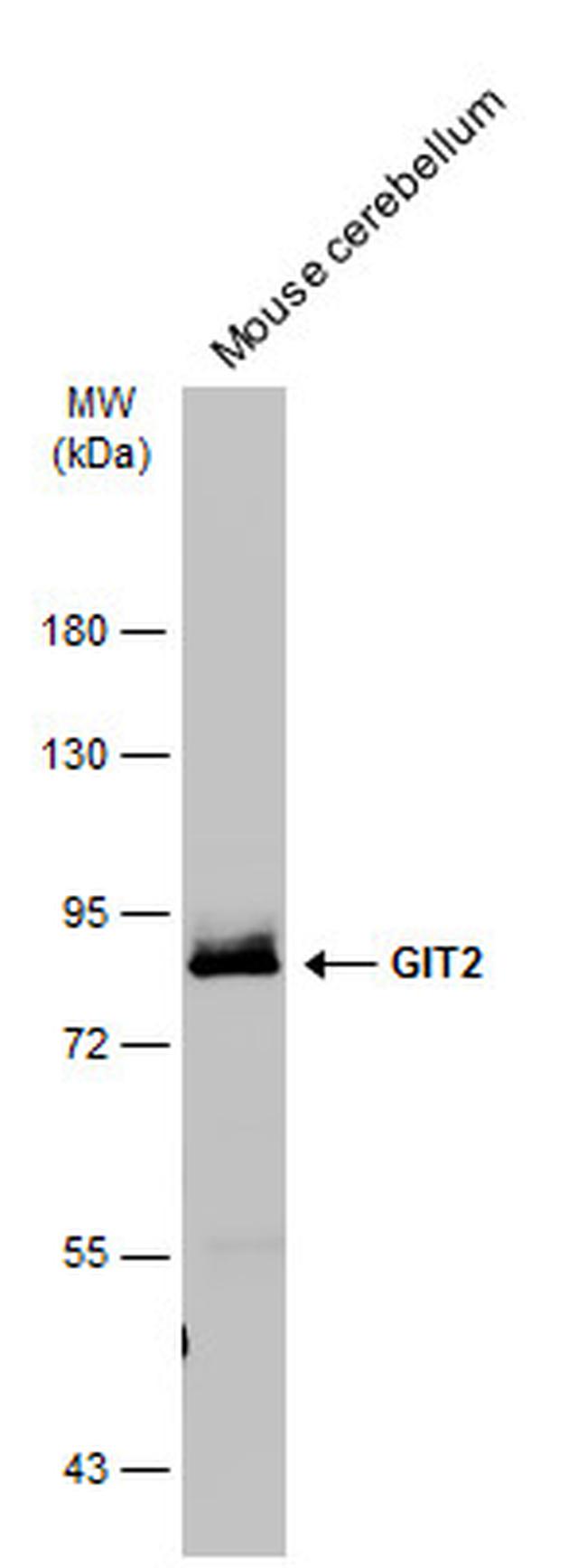 GIT2 Antibody in Western Blot (WB)