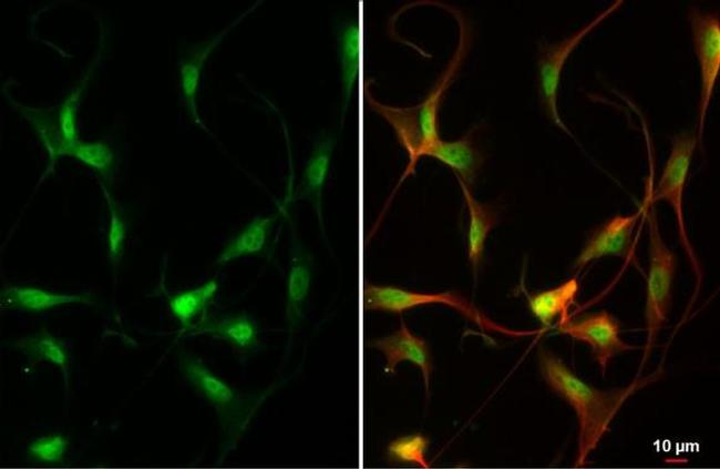 ZEB2 Antibody in Immunocytochemistry (ICC/IF)