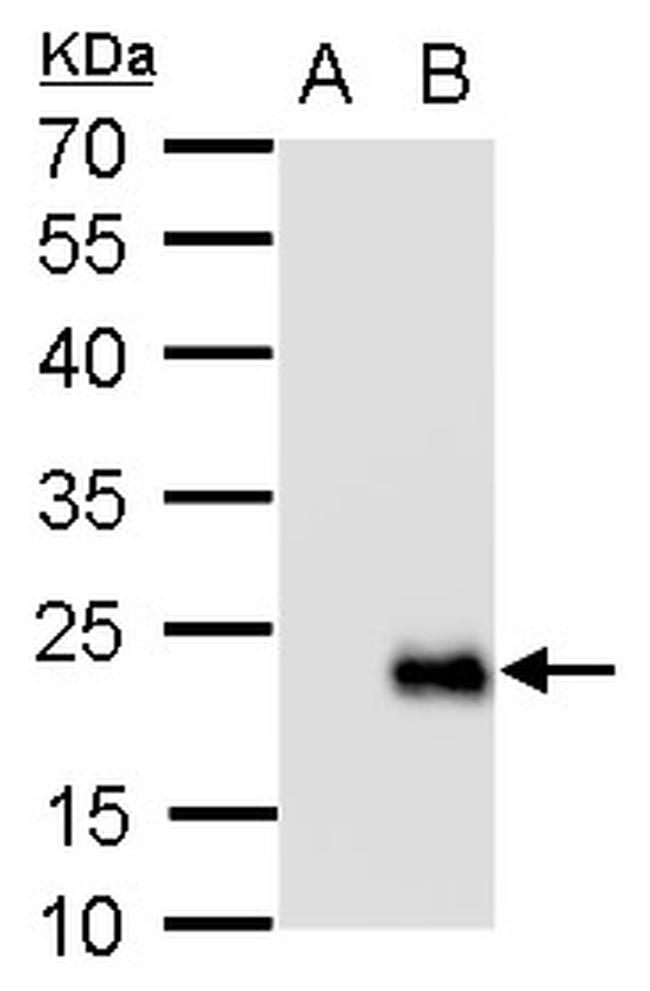 RGS19 Antibody in Western Blot (WB)