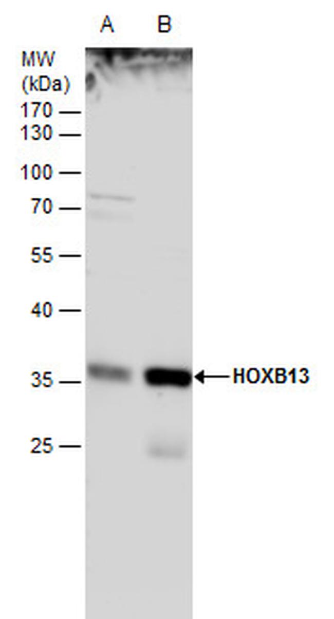 HOXB13 Antibody in Western Blot (WB)