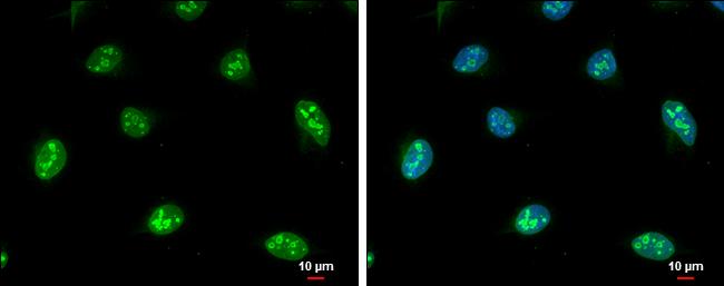 NOP56 Antibody in Immunocytochemistry (ICC/IF)