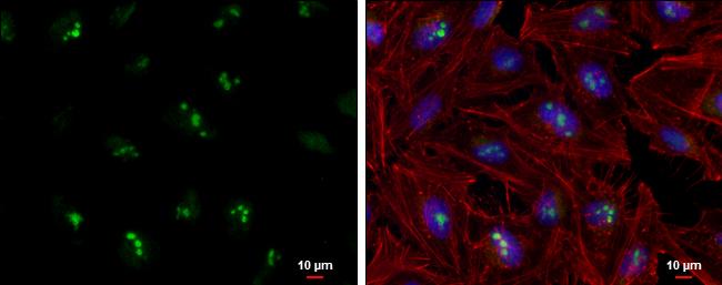 RNAse H2A Antibody in Immunocytochemistry (ICC/IF)