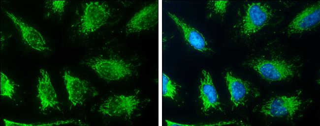 SLC19A2 Antibody in Immunocytochemistry (ICC/IF)