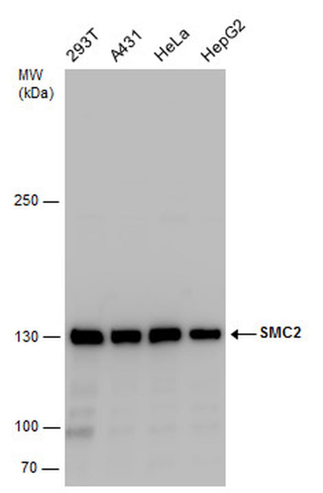 SMC2 Antibody in Western Blot (WB)