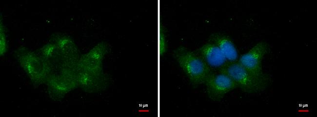 RBCK1 Antibody in Immunocytochemistry (ICC/IF)