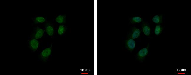 RUVBL2 Antibody in Immunocytochemistry (ICC/IF)