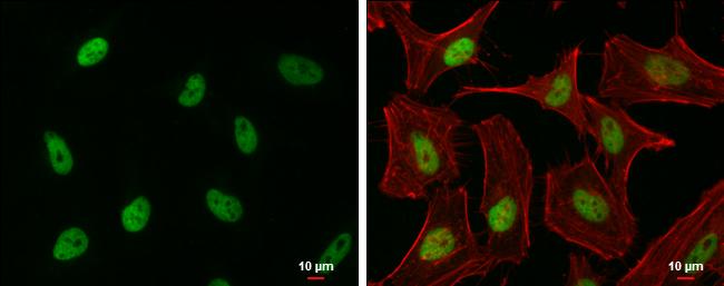 EHMT2 Antibody in Immunocytochemistry (ICC/IF)