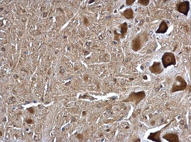 TMP21 Antibody in Immunohistochemistry (Paraffin) (IHC (P))