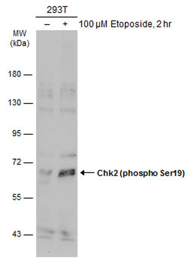 Phospho-CHK2 (Ser19) Antibody in Western Blot (WB)