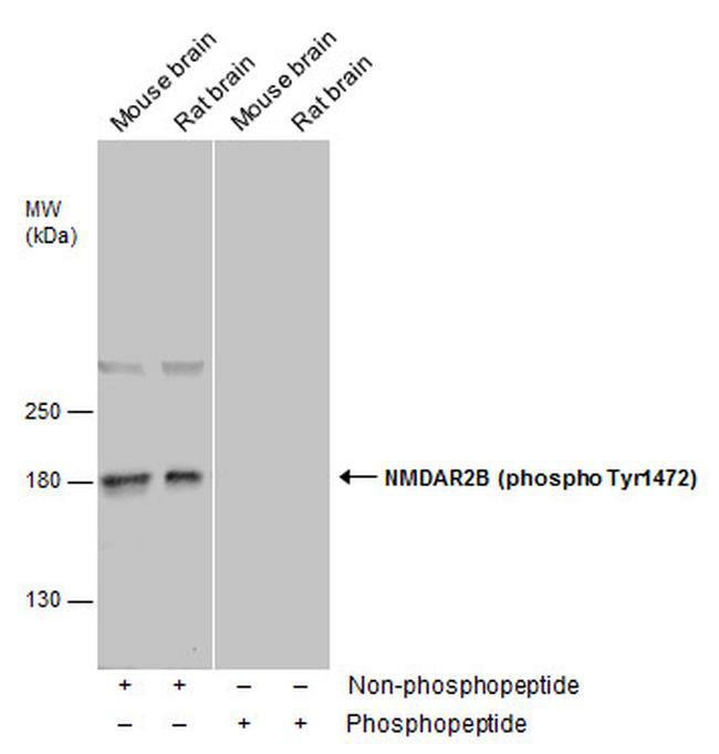 Phospho-NMDAR2B (Tyr1472) Antibody in Western Blot (WB)